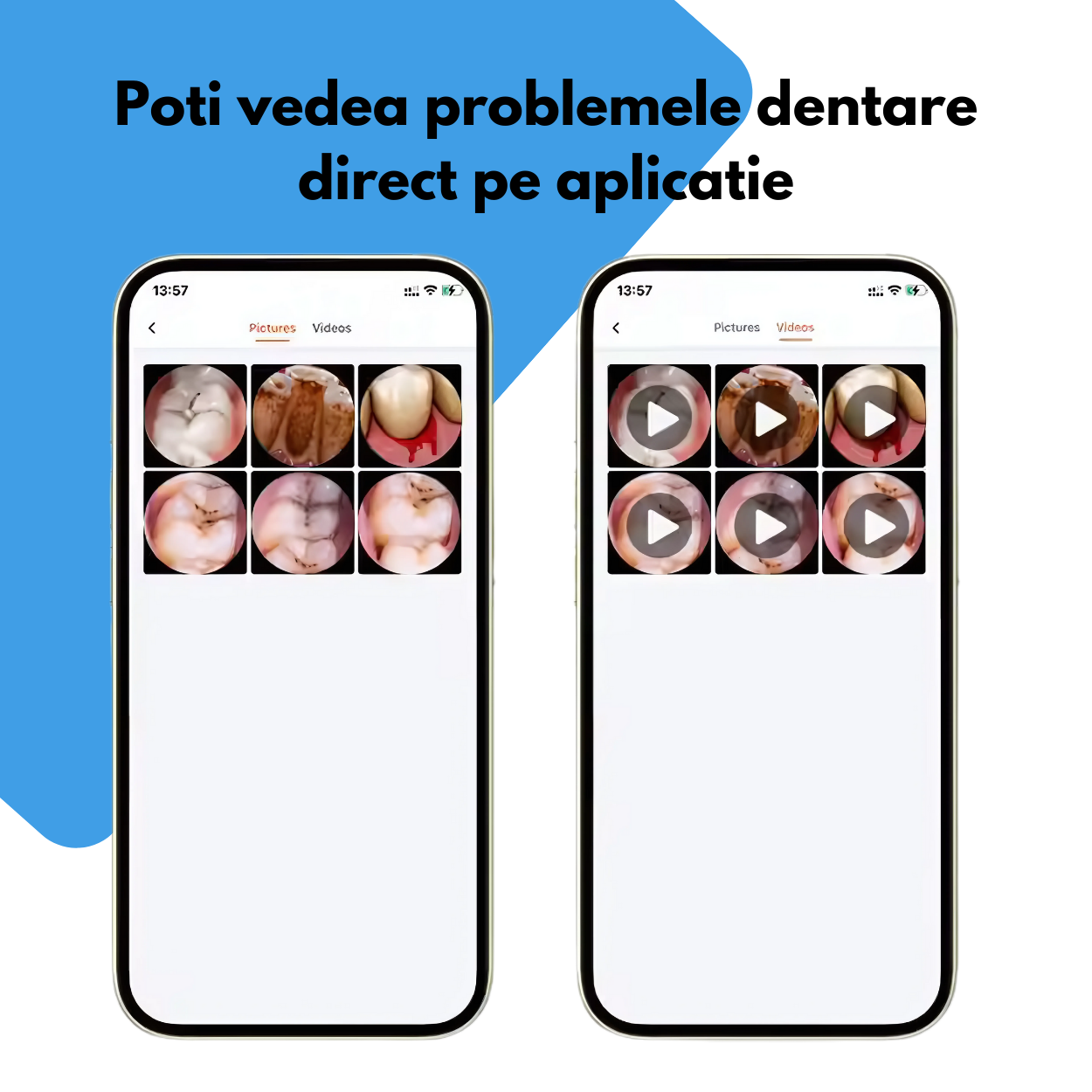 Aparat Profesional pentru Curatarea Urechilor cu Camera 360° HD 